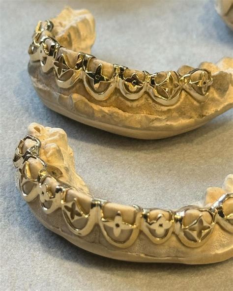 louis vuitton grillz|Dolly Cohen x Louis Vuitton Grillz .